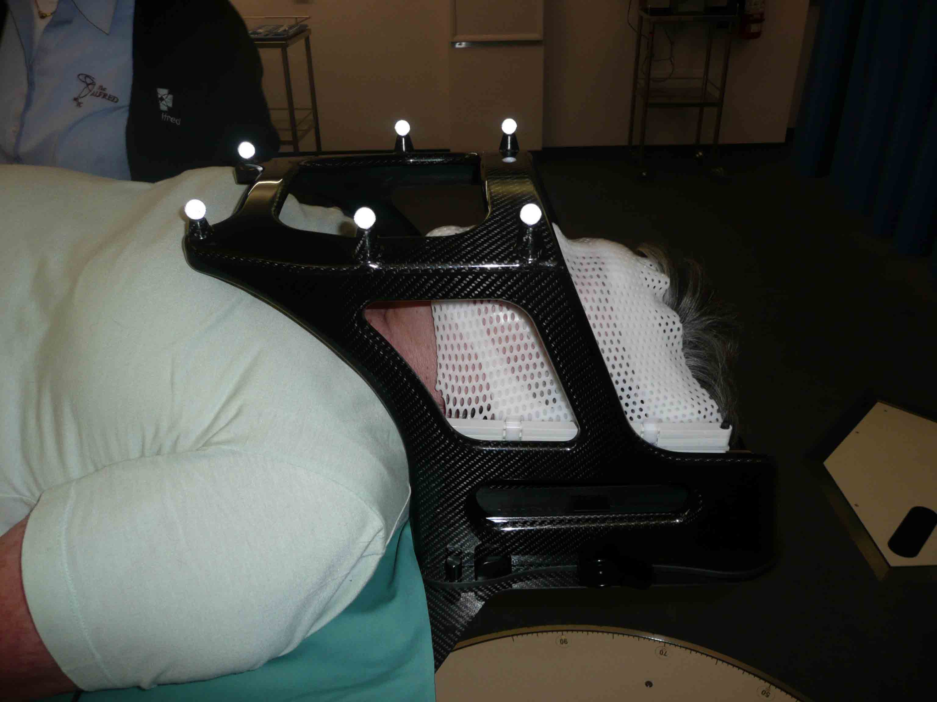 Radio Therapy Mask used for Acoustic Neuroma